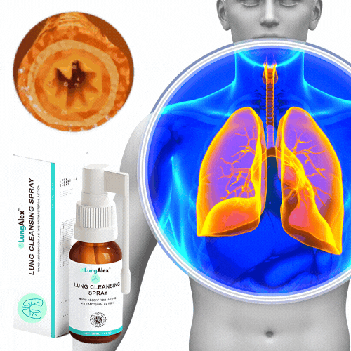 LungAlex™