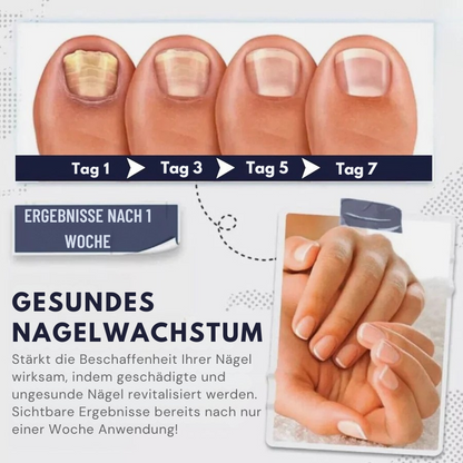 Nailvana™