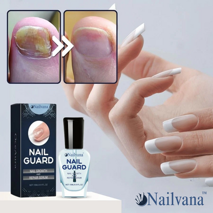 Nailvana™